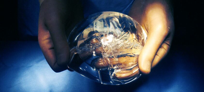 Silikónová endoprotéza