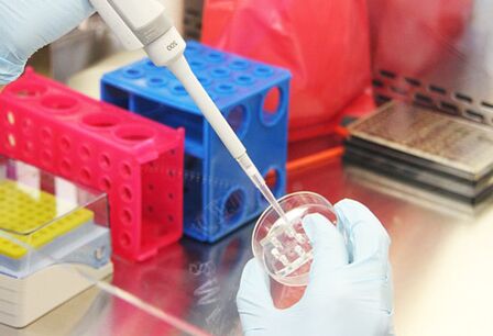 Vyšetrenie testov pacienta pred vykonaním augmentačnej mamoplastiky