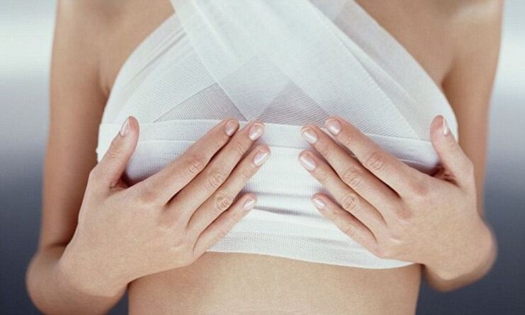 obviazané prsia po operácii na zväčšenie prsníkov